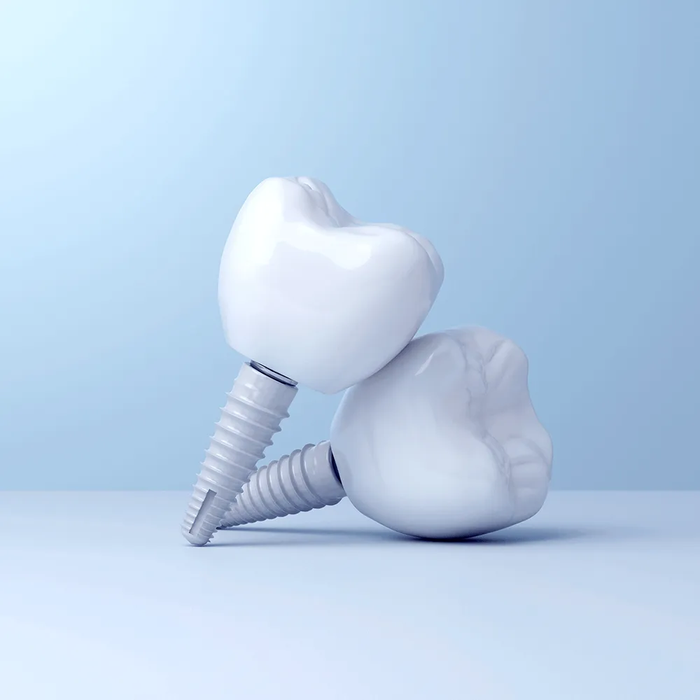 Dental Implants